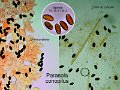 Parasola conopilus-amf1588-micro